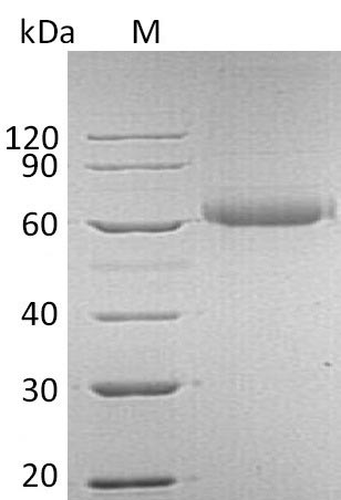Recombinant Human Fibroblast growth factor receptor-like 1(FGFRL1),partial (Active)