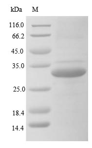 Recombinant Human Ficolin-3(FCN3)