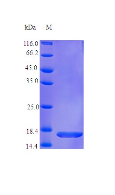 Recombinant Human Fms-related tyrosine kinase 3 ligand protein(FLT3LG) (Active)