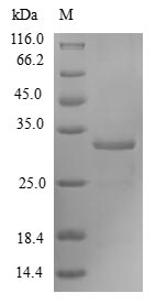 Recombinant Human Forkhead box protein M1(FOxM1),partial
