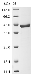 Recombinant Human Fructose-bisphosphate aldolase C(ALDOC)