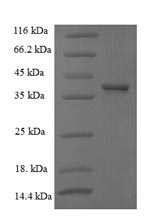 Recombinant Human G1/S-specific cyclin-D1(CCND1)