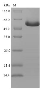Recombinant Human GDNF family receptor alpha-like(GFRAL),partial