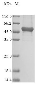 Recombinant Human GTPase NRas(NRAS)