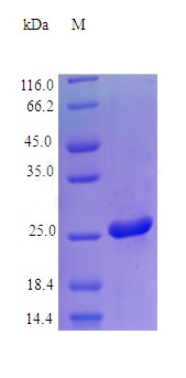 Recombinant Human Galectin-3 protein(LGALS3) (Active)