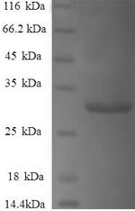Recombinant Human Gamma-synuclein(SNCG)