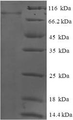 Recombinant Human Glucokinase regulatory protein(GCKR)