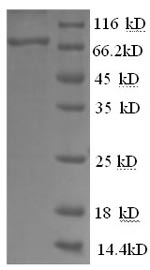 Recombinant Human Glucose-6-phosphate isomerase(GPI),partial