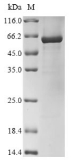 Recombinant Human Glutamate receptor 2(GRIA2),partial