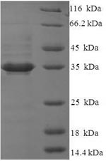 Recombinant Human Glutaminyl-peptide cyclotransferase-like protein(QPCTL),partial