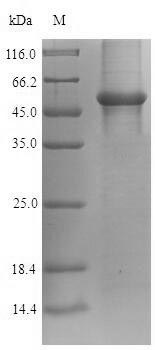 Recombinant Human Glyceraldehyde-3-phosphate dehydrogenase(GAPDH)