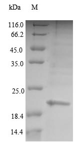 Recombinant Human Glycodelin(PAEP)