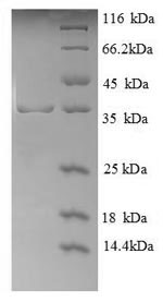 Recombinant Human Glycophorin-A(GYPA),partial