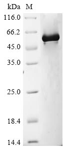 Recombinant Human Glypican-1(GPC1),partial