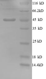 Recombinant Human Golgi membrane protein 1(GOLM1),partial