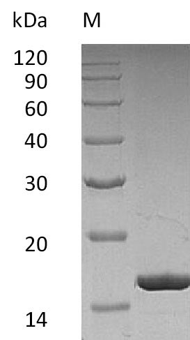 Recombinant Human Granulocyte colony-stimulating factor(CSF3),partial (Active)
