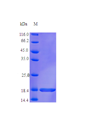 Recombinant Human Granulocyte colony-stimulating factor protein(CSF3) (Active)