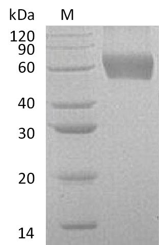 Recombinant Human Granulocyte-macrophage colony-stimulating factor receptor subunit alpha(CSF2RA),partial (Active)