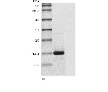 Recombinant Human Growth/differentiation factor 7(GDF7)