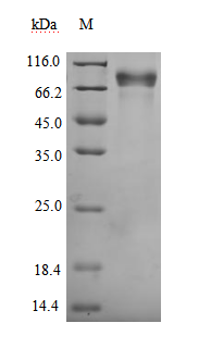 Recombinant Human Growth hormone receptor(GHR),partial,Biotinylated (Active)