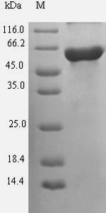 Recombinant Human Guanine nucleotide-binding protein G(s) subunit alpha isoforms short(GNAS)