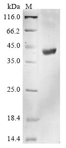 Recombinant Human HLA class I histocompatibility antigen,A-1 alpha chain(HLA-A),partial