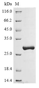 Recombinant Human HLA class II histocompatibility antigen, DR beta 5 chain(HLA-DRB5),partial
