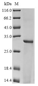 Recombinant Human HLA class II histocompatibility antigen, DRB1-3 chain(HLA-DRB1),partial