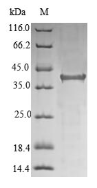 Recombinant Human Hereditary hemochromatosis protein(HFE),partial