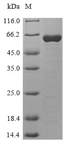 Recombinant Human Histone PARylation factor 1(HPF1)  
