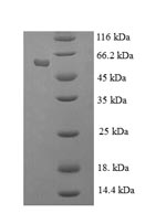 Recombinant Human Histone-binding protein RBBP7(RBBP7)
