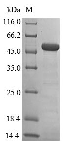 Recombinant Human Histone-lysine N-methyltransferase SETD7(SETD7),partial