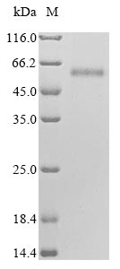 Recombinant Human Hyaluronidase-2(HYAL2)