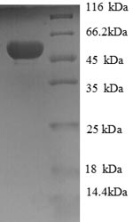 Recombinant Human Hydroxyacylglutathione hydrolase, mitochondrial(GLO2),partial