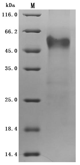 Recombinant Human IGF-like family receptor 1(IGFLR1),partial (Active)