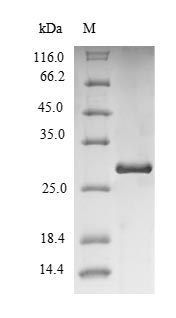 Recombinant Human Immunoglobulin iota chain(VPREB1)