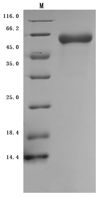 Recombinant Human Inactive tyrosine-protein kinase transmembrane receptor ROR1(ROR1),partial (Active)