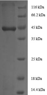 Recombinant Human Insulin-like growth factor I(IGF1)