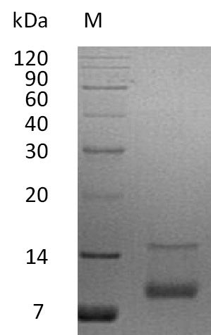 Recombinant Human Insulin-like growth factor I(IGF1),partial (Active)