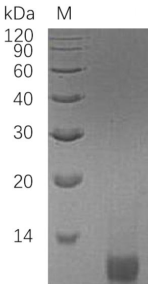 Recombinant Human Insulin-like growth factor II(IGF2) (Active)