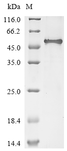 Recombinant Human Inter-alpha-trypsin inhibitor heavy chain H3(ITIH3),partial