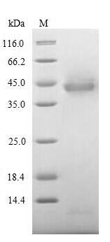 Recombinant Human Inter-alpha-trypsin inhibitor heavy chain H4(ITIH4),partial