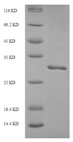 Recombinant Human Inter-alpha-trypsin inhibitor heavy chain H5(ITIH5)，Partial