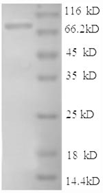 Recombinant Human Intercellular adhesion molecule 1(ICAM1),partial