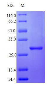 Recombinant Human Interferon alpha-2 protein(IFNA2) (Active)