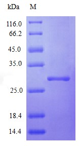Recombinant Human Interferon alpha-2 protein(IFNA2) (Active)