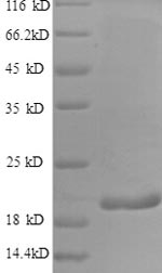 Recombinant Human Interferon gamma(IFNG)