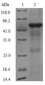 Recombinant Human Interferon-induced helicase C domain-containing protein 1(IFIH1),partial
