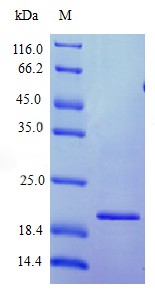 Recombinant Human Interferon omega-1 protein(IFNW1) (Active)