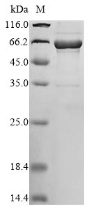 Recombinant Human Interleukin-1 alpha(IL1A),Biotinylated